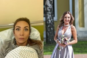 Gerdai Žemaitei prireikė operacijos: su šia problema susiduria daugybė moterų