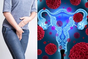 Onkologai ragina moteris nesnausti: tai gali perpus sumažinti tikimybę mirti nuo vėžio