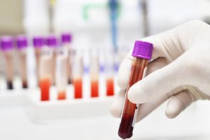 Lietuvoje pernai užfiksuota mažiau ŽIV atvejų nei 2018 metais