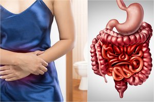 Kodėl pučia pilvą? Gydytojas įvardijo dažniausias priežastis ir sprendimo būdus