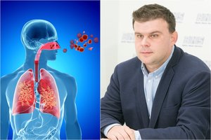 Medikas įspėjo: jeigu pastebėjote šiuos gripo simptomus, į gydytoją kreipkitės iškart