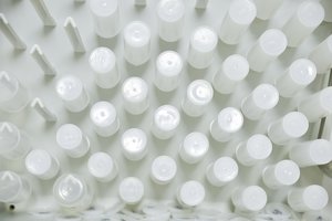 Lietuvos žemės ūkio atašė neliks Italijoje, atsiras Jungtiniuose Arabų Emyratuose