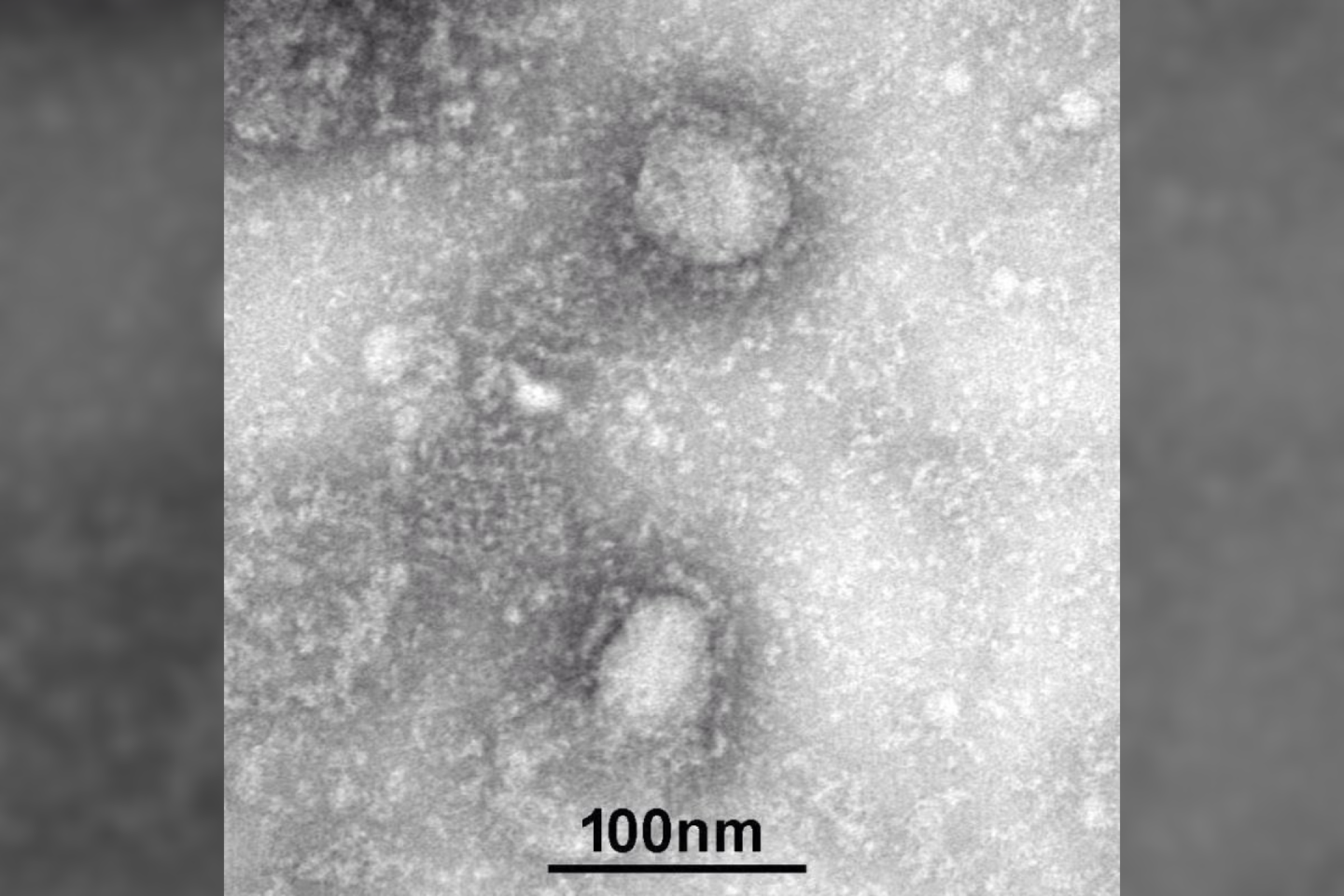 Realus 2019-nCoV, matomas per mikroskopą.<br> CDC.gov iliustr.