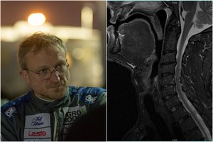 Sauliaus Jurgelėno reabilitacija po Dakaro ralio užtruks mažiausiai dar mėnesį