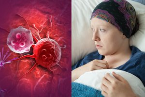 Gydytojai įspėjo: dėl šių priežasčių mirštamumas nuo vėžio nemažėja