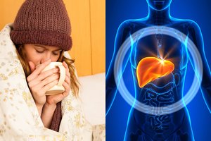 Dėl populiarių vaistų gresia ir sunkūs kepenų pažeidimai: patarė, kaip atpažinti apsinuodijimą