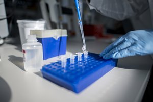 Nustatė, kaip ilgai koronavirusai išlieka ant paviršių