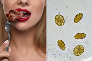 Gydytoja patarė, kaip valgantiems mėsą išvengti nemalonios parazitinės ligos