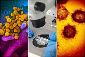 Parodė, kaip iš tiesų atrodo virusas-žudikas