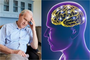 Mokslininkai nustatė, kas smarkiai padidina Alzheimerio ligos riziką: vyrus paveikti gali ypač stipriai