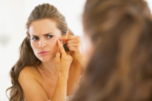 Aknė – ne tik paauglių liga: specialistė patarė, kokių produktų vengti turintiems spuogų
