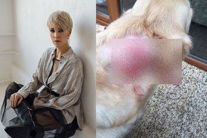 Simonos Jakubėnaitės augintinę sužalojo agresyvus šuo: perspėja kitus šeimininkus