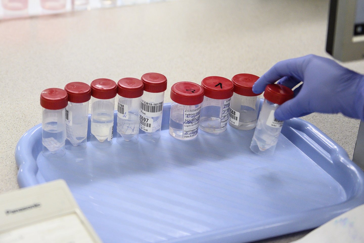 Koronavirusas turi dvi atmainas.<br>V.Skaraičio asociatyvi nuotr.