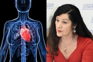 Profesorė pasakė, kokie netipiniai simptomai įspėja apie moterų širdies ir kraujagyslių ligas