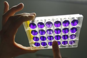 Lietuvoje dėl koronaviruso grėsmės stebi daugiau kaip 5 tūkst. žmonių: pradėti tirti 6 ėminiai