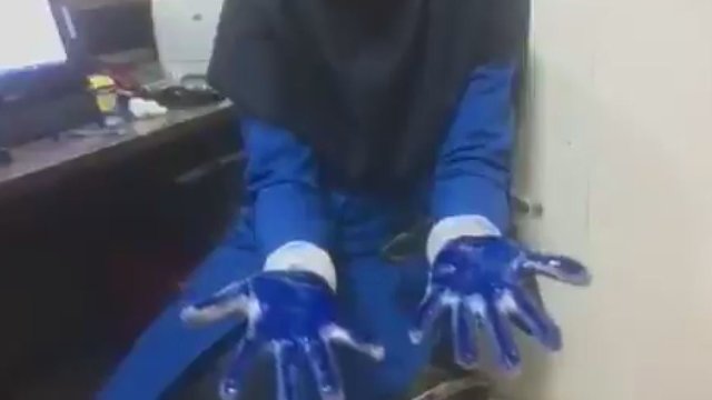 Gydytoja parodė, kur gali pasilikti virusas neteisingai plaunant rankas