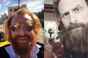 Koronavirusu užsikrėtė „Sostų karų“ žvaigždė