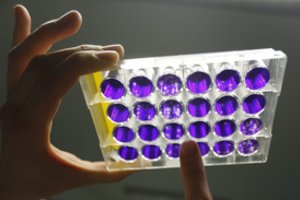 Į Lietuvą atkeliauja daugiau koronaviruso infekcijai nustatyti reikalingų reagentų