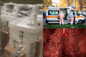 Italija rado būdą, kaip gelbėti sunkios būklės Covid-19 ligonius