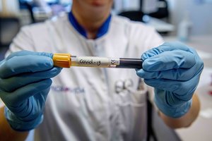 Per parą Lietuvoje nustatytas 21 koronaviruso atvejis, užsikrėtusiųjų skaičius išaugo iki 69