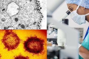 Dar viena viltis? Nyderlandų mokslininkai skelbia radę būdą, kaip sunaikinti koronavirusą: tai antikūnas „47D11“