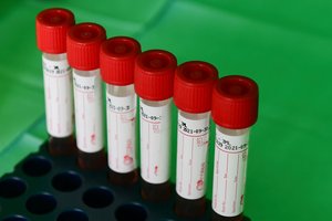 PSO vadovams – baltarusių pagalbos prašymas