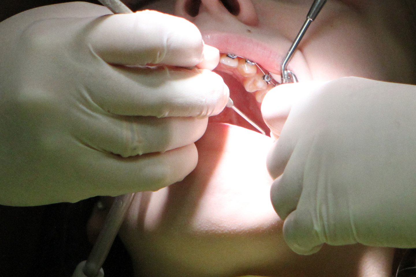 Suskaičiuota, kad iš viso per dvejus metus įmonės vadovė nuslėpė 7,2 tūkst. eurų gautų pajamų už suteiktas odontologijos paslaugas.<br>M.Patašiaus nuotr.