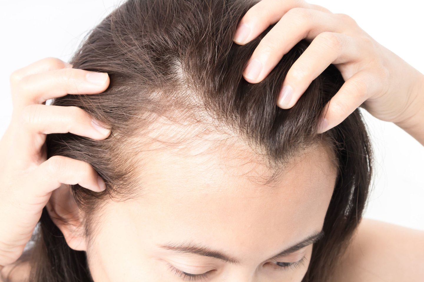 Plaukų augimui skatinti ir jų blizgesiui bei švelnumui reikia ir tokių medžiagų kaip pantoteno rūgštis ir biotinas.<br>123rf nuotr.