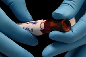 Sukurta daugiau nei 100 koronaviruso vakcinų „kandidačių“: įsitraukti gali ir Lietuvos mokslininkai