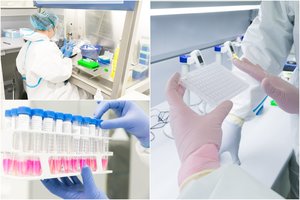 Šioje Lietuvos laboratorijoje buvo aptiktas ypatingas koronaviruso atvejis: parodė iš arčiau, kaip vyksta tyrimai