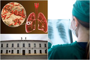 Kėdainių gimnazijoje – įtampa: nustatė pavojingą užkrečiamą ligą, galėjo turėti 100 kontaktų