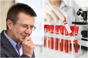 Profesorius paaiškino, kodėl mus puola koronavirusai: juos pažaboti galima dviem būdais