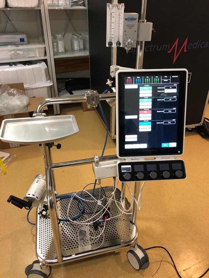  R.Danisevičiaus nuotr.<br> Šis EKMO aparatas, kurio kaina – apie 200 tūkst. eurų, yra ketvirtas ir naujausias iš visų Santaros klinikų turimų tokių aparatų.