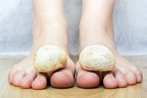 Pėdų grybelis gresia ir tvarkingiems: tai gali būti rimtesnių ligų ženklas