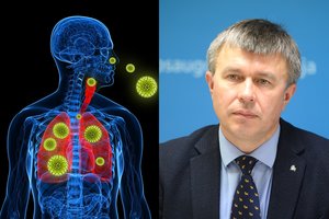 Neurologas įspėjo apie netradicinius COVID-19 simptomus: vienas pasireiškia dviem trečdaliams