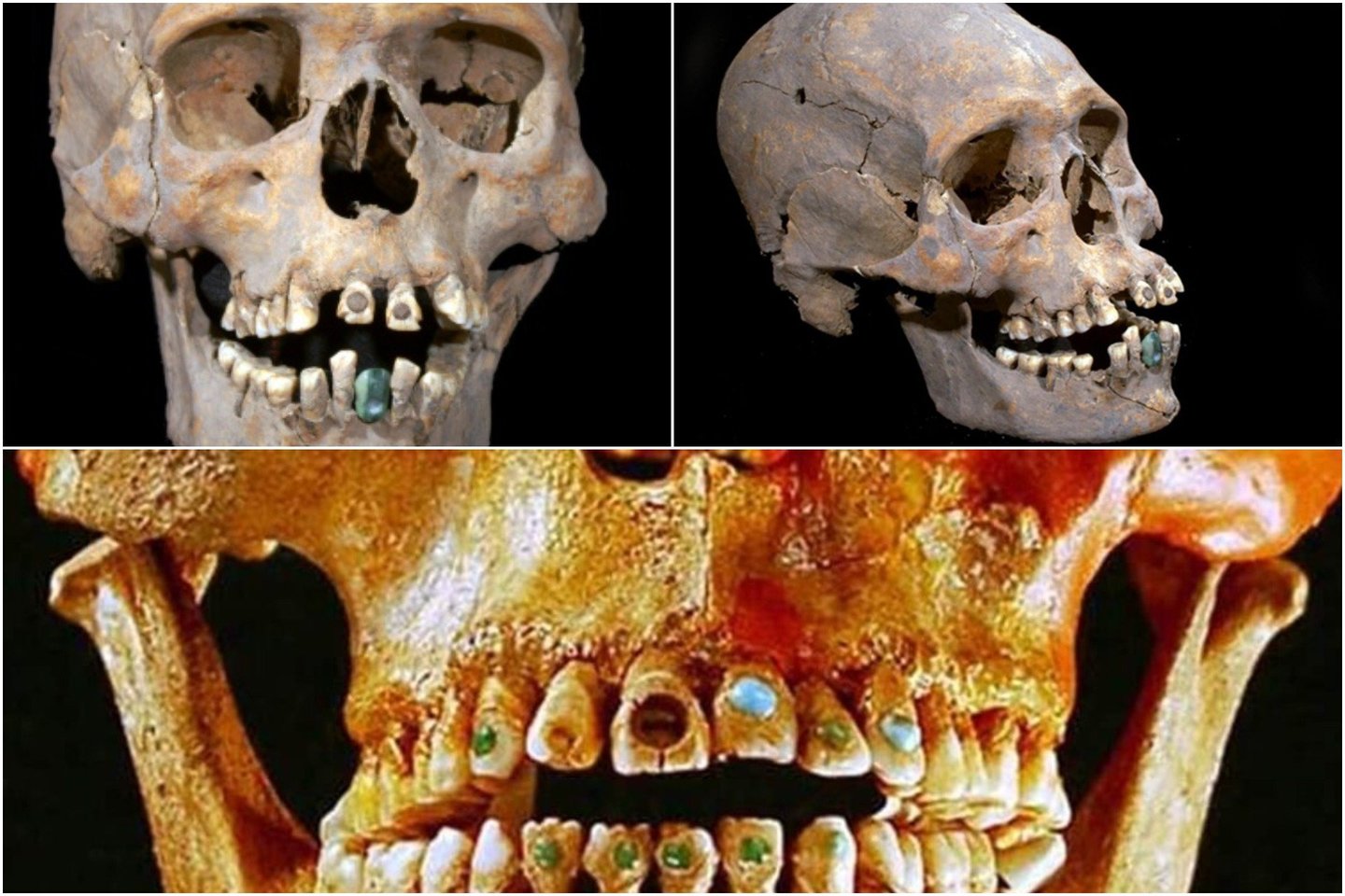  Archeologai netoli senovinių Teotihuakano (Meksika) griuvėsių rado 1600 metų aukštuomenės moters skeletą, kurio kaukolė buvo sąmoningai deformuota, dantys – inkrustuoti spalvingais mineralais.<br> „Archeology Today“ nuotr.