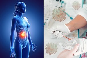 Liga, kuria sergantys pacientai – didelės COVID-19 rizikos grupėje