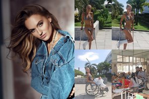 Gintarė Gurevičiūtė prabilo apie avariją ir parodė randus: „Kai niekas nemato – šlubuoju“