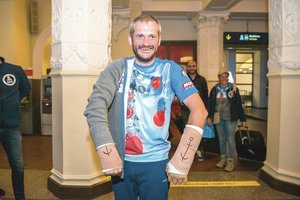 Kraupius sužalojimus patyręs Balys Bardauskas atskleidė, kaip tenka gyventi