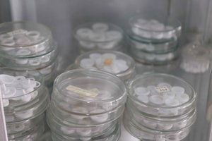 Lietuviai su Europos ir JAV mokslininkais kuria medžiagą, kuri leis diagnozuoti plika akimi nematomus pažeidimus