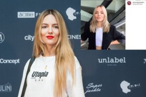 Žinoma tinklaraštininkė Simona Burbaitė ryžosi kardinaliems pokyčiams: „Reiks priprasti“