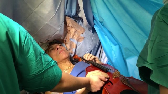 Neįtikėtina: Vilniuje atviros smegenų operacijos metu vyras griežė altu