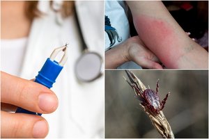 Gydymo įstaigose – įsisiautėjusių parazitų išsigandusių lietuvių antplūdis