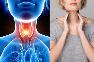 Skydliaukės sutrikimų turi kone trečdalis Lietuvos gyventojų: išvardijo, kokie požymiai apie tai įspėja