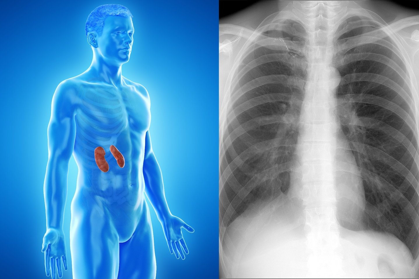 Kompiuterinės tomografijos nuotraukos gali padėti atskleisti ne tik ligos priežastį.<br>123rf nuotr.