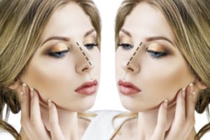 Ši grožio procedūra tapo viena populiariausių: nereikia nė skalpelio