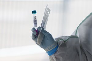 Į koronaviruso atvejo apibrėžimą įtraukti papildomi infekcijos simptomai