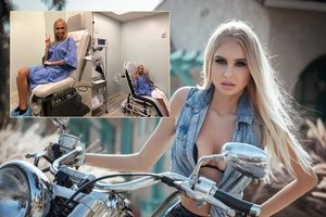 Simonai Milinytei prireikė rimtos operacijos