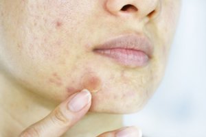 Netikėti organizmo signalai, rodantys, kad reikėtų atsisakyti grūdų