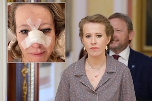 38-erių Ksenija Sobčiak atsidūrė ligoninėje